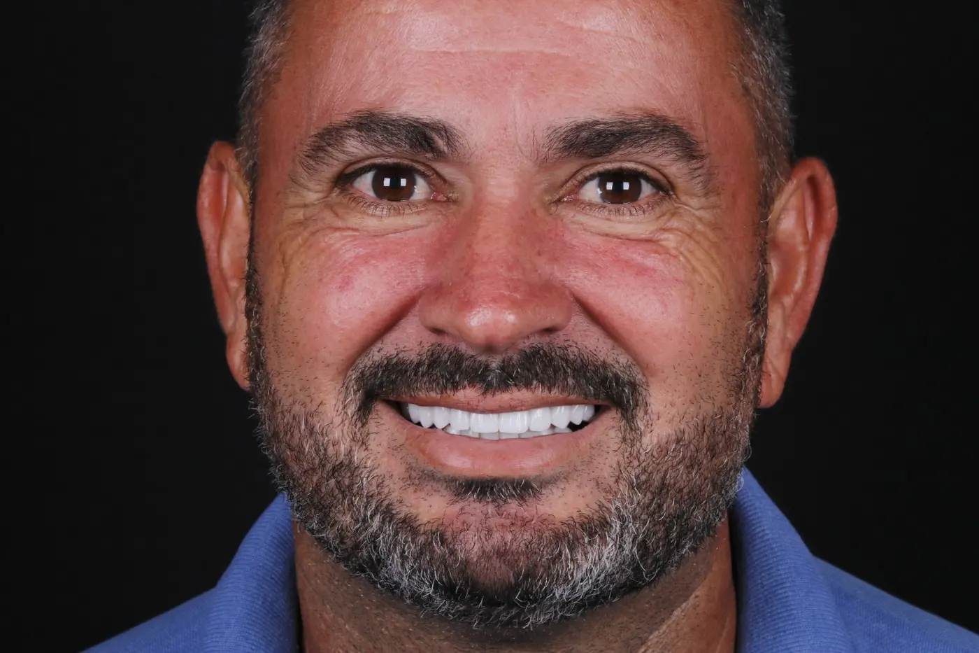 Paciente sorrindo após tratamento odontológico
