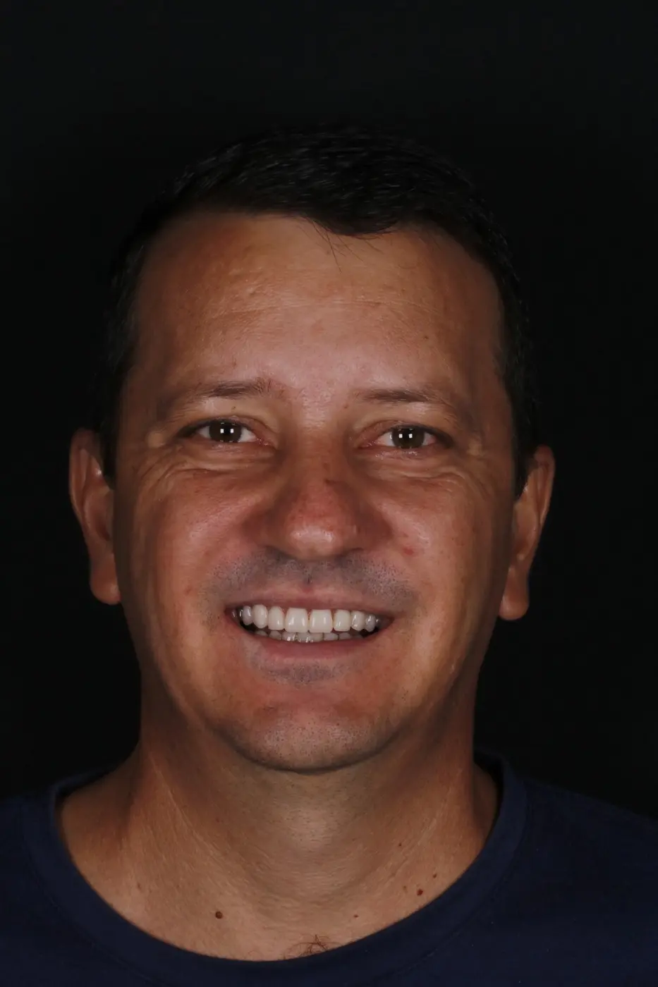 Paciente com sorriso finalizado