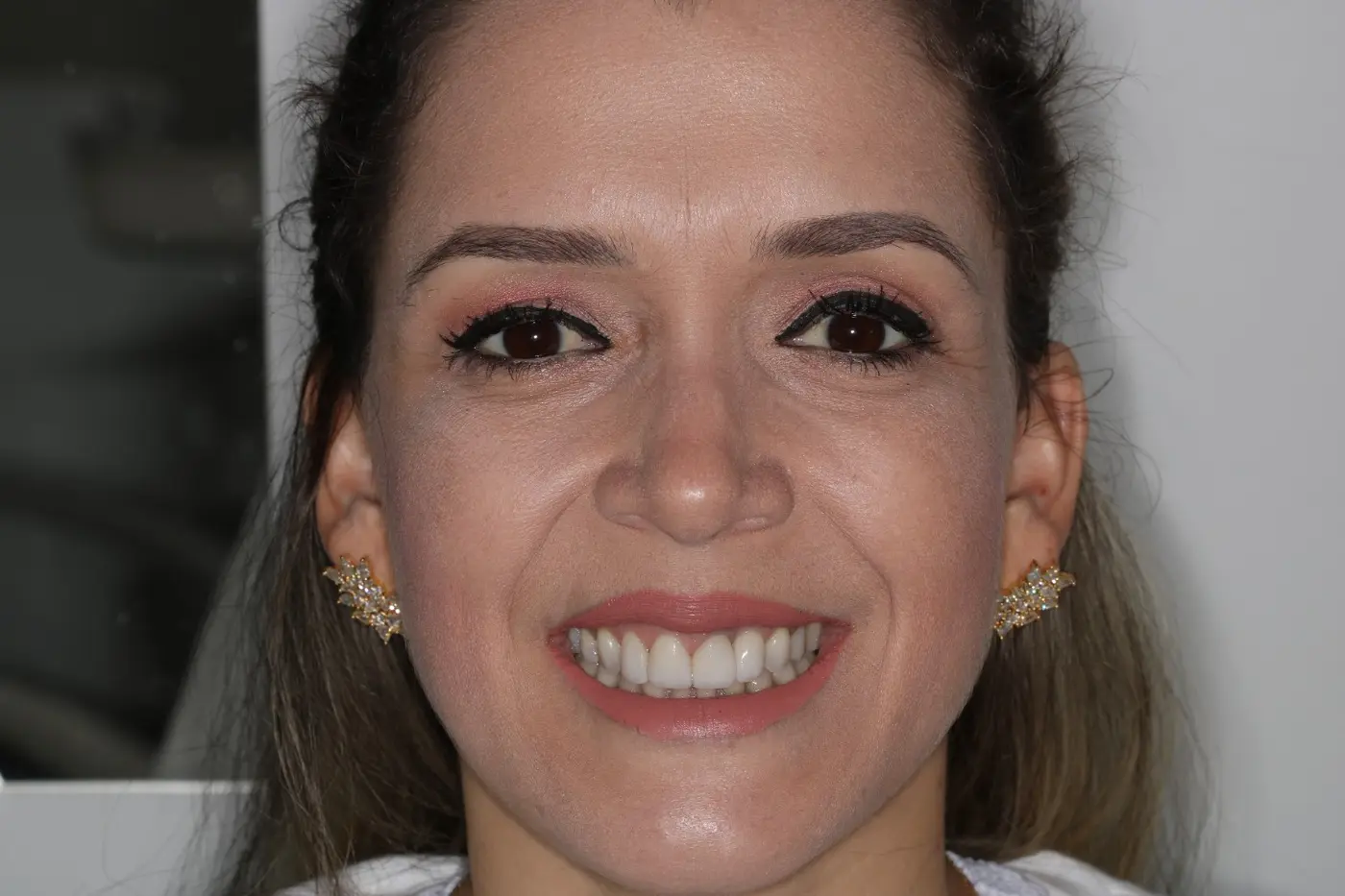 Paciente sorrindo após atendimento na clínica