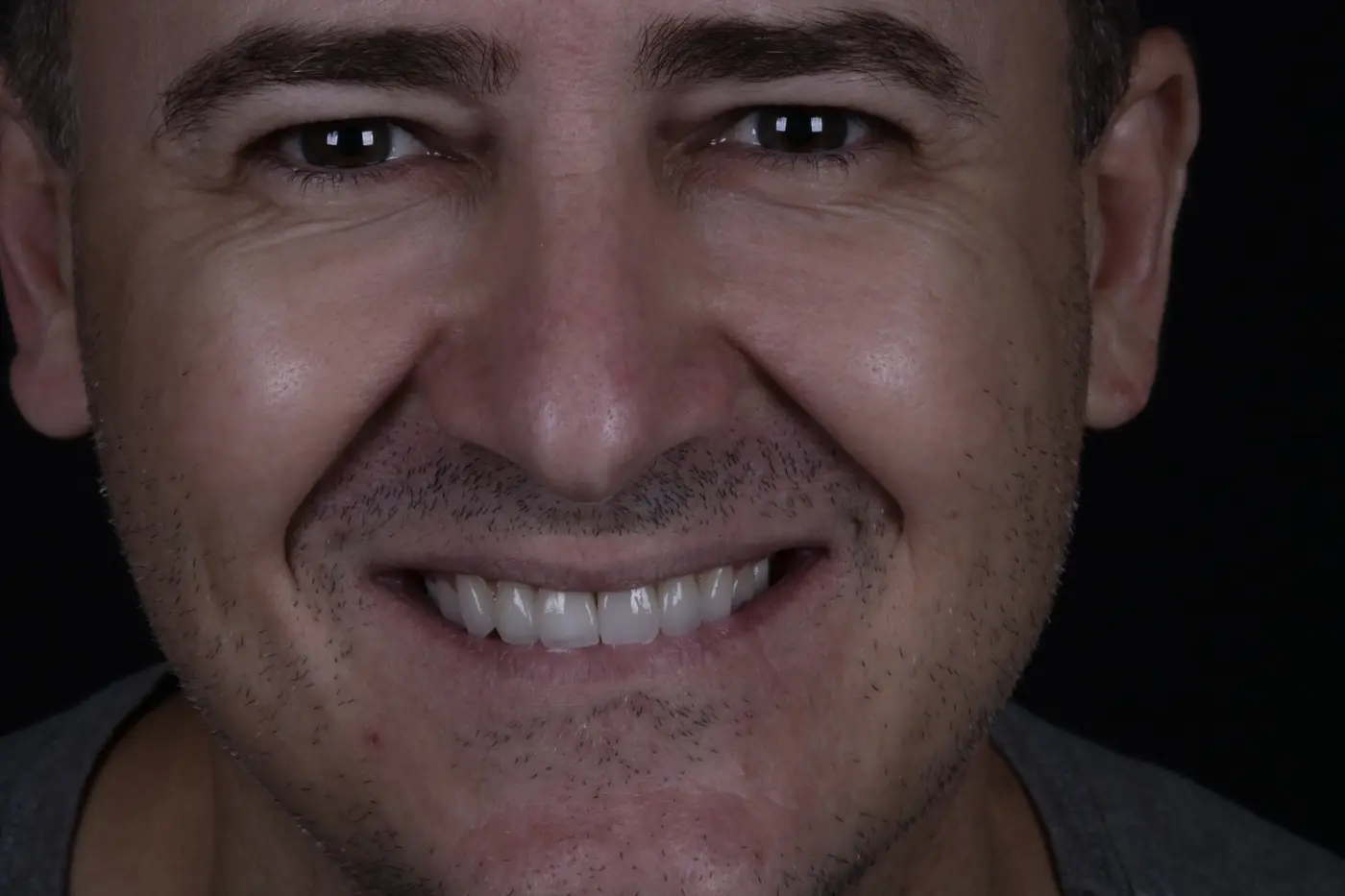 Paciente com sorriso reabilitado